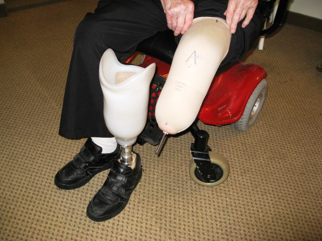 Prosthetic Leg Sleeve Bolt Alignment Device